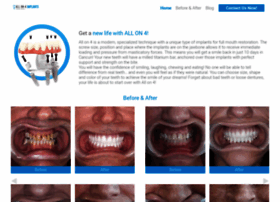 allon4implants.dental