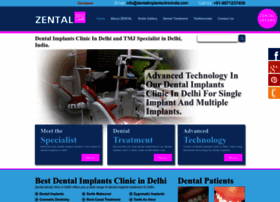 dentalimplantsclinicindia.com