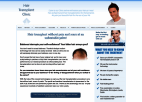 hair-transplant-clinic.co.uk