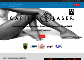 capitallaser.net