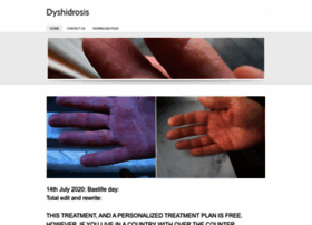 dyshidrosis.co.uk